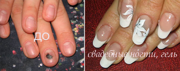  фото ногтей до и после наращивания